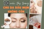 Nước tẩy trang cho da dầu mụn không cồn
