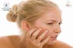 Cách triệt lông mặt vĩnh viễn tại nhà