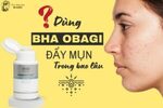 BHA Obagi đẩy mụn trong bao lâu