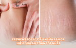 DẦU NGỪA RẠN DA