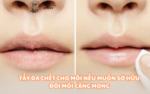 Tẩy da chết cho môi