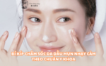 DA DẦU MỤN NHẠY CẢM